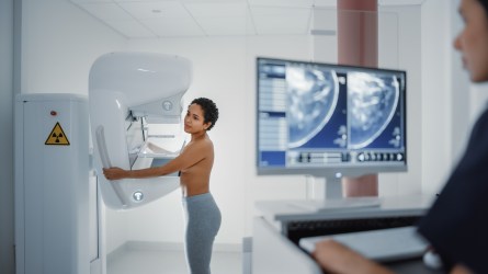 Computer Screen in Hospital Radiology Room: Beautiful Multiethnic Young Woman Standing Topless Undergoing Mammography Screening Procedure. Screen Showing the Mammogram Scans of Dense Breast Tissues.