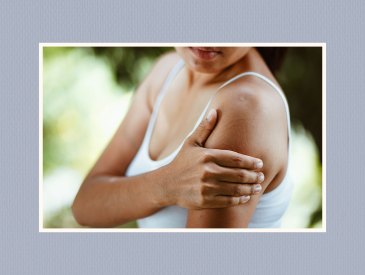 Woman scratching arm