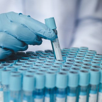 Lab assistant, medical scientist, chemistry researcher holds a glass tube through a chemical test tube, does a chemical experiment and examines a patient's sample. Medicine and research concept.