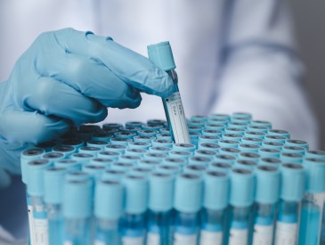 Lab assistant, medical scientist, chemistry researcher holds a glass tube through a chemical test tube, does a chemical experiment and examines a patient's sample. Medicine and research concept.